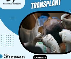 Hair Transplant Cost-Hair Transplant Clinics in Bangalore