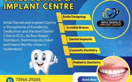 Best Dentist in Kapra | Best Dental Hospital in Kapra