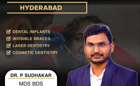 Best Dental Doctor in AS Rao Nagar | Top Dentist in AS Rao Nagar