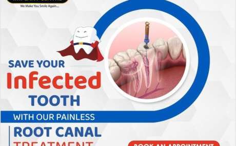 How do I find a reliable clinic for root canal treatment near me?