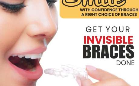 Invisible Braces: The Secret to Straightening Your Teeth