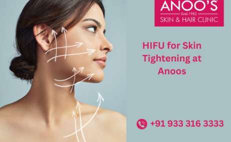 Advanced HIFU  treatment  for Skin Tightening at Anoos